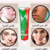 كريم فيسكا Vesca Forte لإزالة حب الشباب الكلف والنمش والتصبغات الجلدية