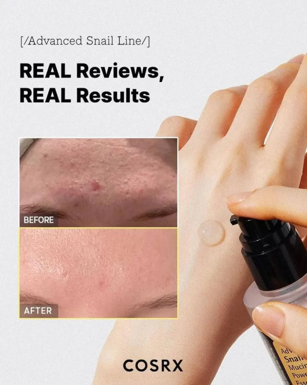 ⁦COSRX Advanced Snail 96 Mucin Power Essence - منتجات كورية⁩ - الصورة ⁦8⁩