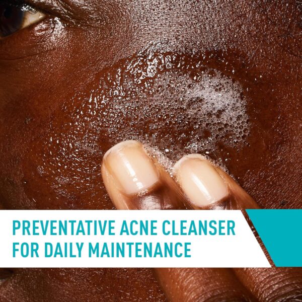 ⁦غسول CeraVe Acne Control Cleanser, 2% Salicylic حجم 236 مل⁩ - الصورة ⁦6⁩