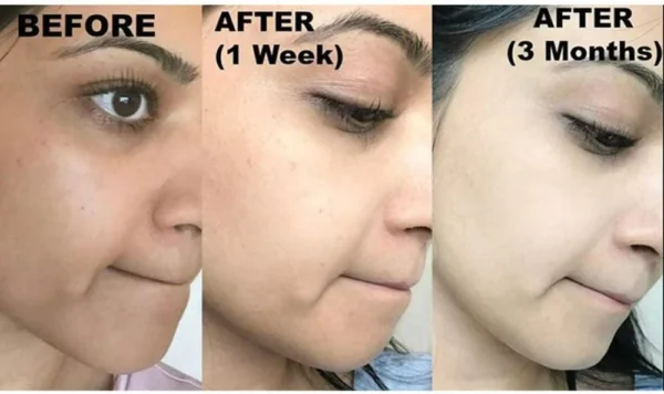 ⁦كريم Kojie San Whitening Cream فلبيني اصلي لتفتيح البشرة 30g⁩ - الصورة ⁦6⁩
