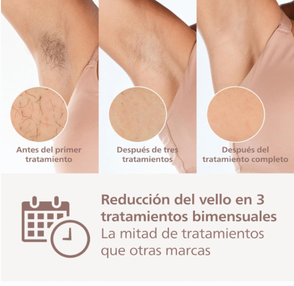 ⁦جهاز ليزر Philips Hair Removal Device - 9000 Series BRI958 كامل الجسم⁩ - الصورة ⁦5⁩