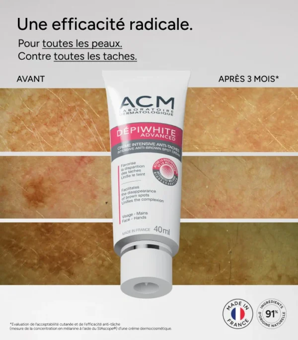 ⁦كريم ACM لإزالة البقع الداكنة Dépiwhite Advanced Intensive Anti-Brown Spot Cream⁩ - الصورة ⁦3⁩