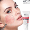 كريم ACM Rosakalm - Rougeurs Anti-redness لاحمرار البشرة الحساسة