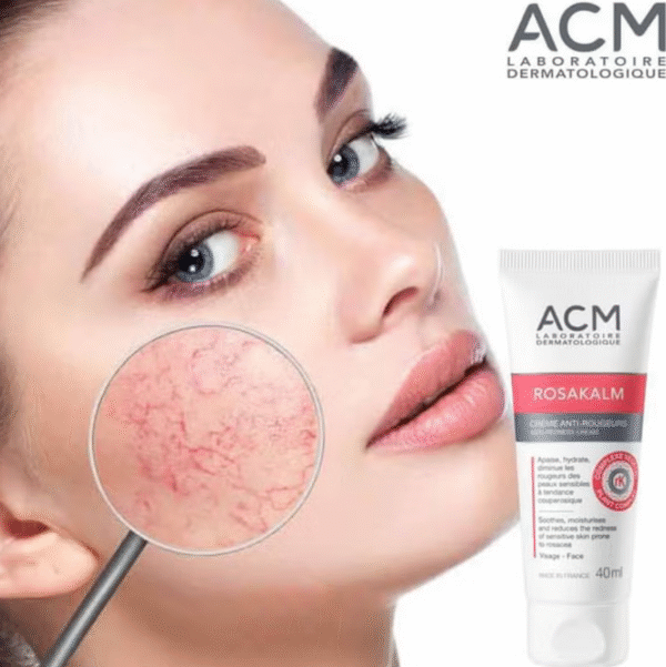 ⁦كريم ACM Rosakalm - Rougeurs Anti-redness لعلاج احمرار البشرة الحساسة⁩ - الصورة ⁦10⁩