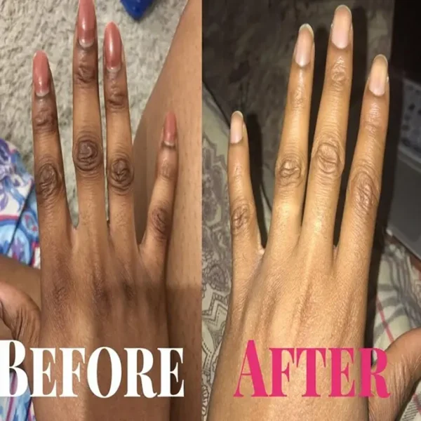 ⁦سيروم Carotone الافريقي مركز للبقع الداكنة Black Spot Corrector Serum⁩ - الصورة ⁦4⁩