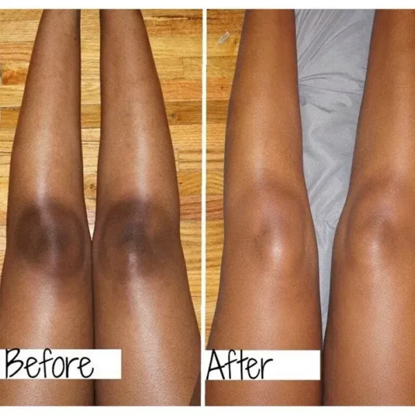 ⁦سيروم Carotone الافريقي مركز للبقع الداكنة Black Spot Corrector Serum⁩ - الصورة ⁦5⁩