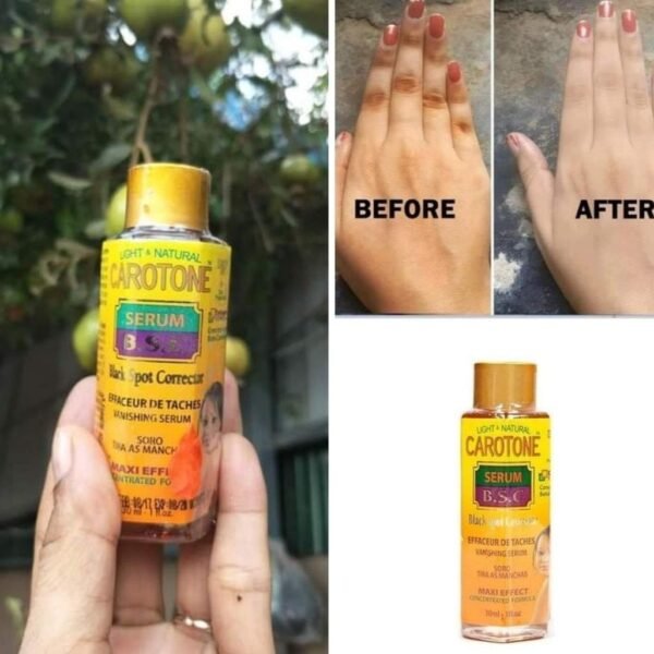 ⁦سيروم Carotone الافريقي مركز للبقع الداكنة Black Spot Corrector Serum⁩ - الصورة ⁦3⁩