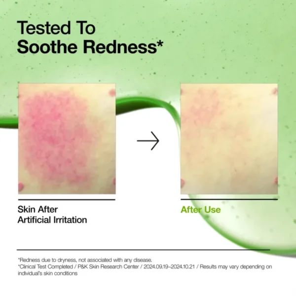 ⁦سيروم Anua Azelaic Acid 10+ Hyaluron Redness Soothing لتهدئة الاحمرار – منتجات كورية⁩ - الصورة ⁦15⁩