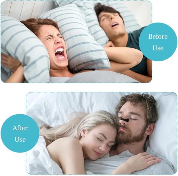 شريط أنف مغناطيسي – حل مبتكر لتحسين التنفس والنوم