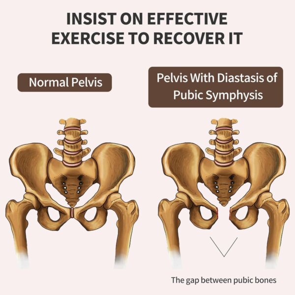 جهاز تمارين الساقين والورك الجانبي  (Leg and Hip Lateral Trainer) السلايدر الجانبي