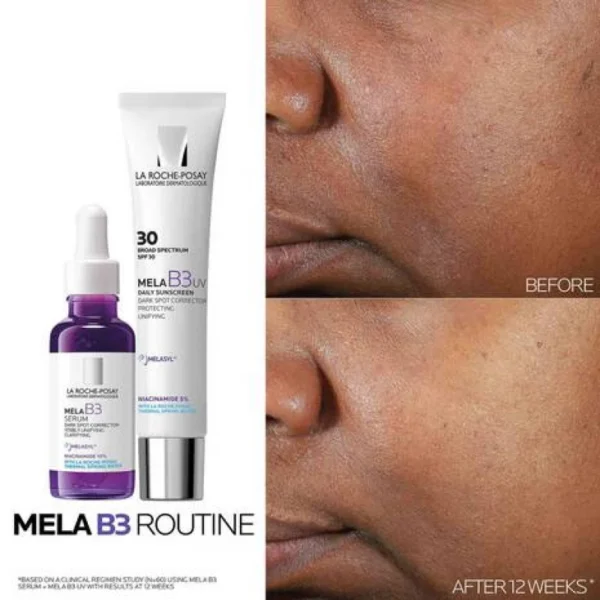 ⁦سيروم للبقع الداكنة La Roche-Posay Mela B3 Intense Anti-Dark Spot⁩ - الصورة ⁦6⁩