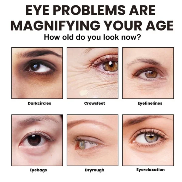 كريم الريتينال للعيون للهالات السوداء والتجاعيد  SEOUL 1988 Eye Cream : Retinal Liposome 4%  - منتجات كورية