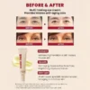 كريم الريتينال للعيون للهالات السوداء والتجاعيد  SEOUL 1988 Eye Cream : Retinal Liposome 4%  - منتجات كورية