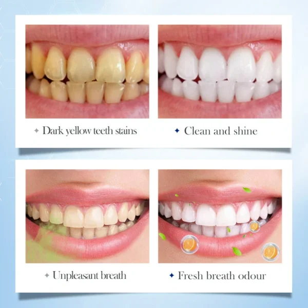 اقراص بديل معجون الاسنان - تنظيف و تبييض و إزالة البقع الصفراء خلال ثواني GRAPES