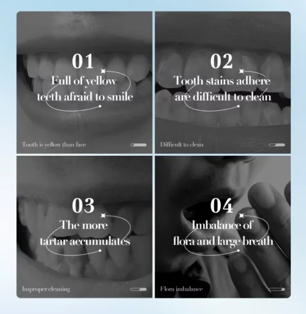 بودرة تبييض الاسنان SADOER Bright White لإزالة الاصفرار والبقع والجير