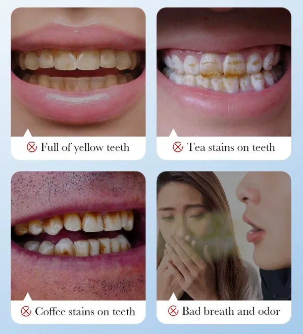 بودرة فحم البامبو لتبييض وتنظيف الأسنان بقع والرواسب العنيدة SADOER