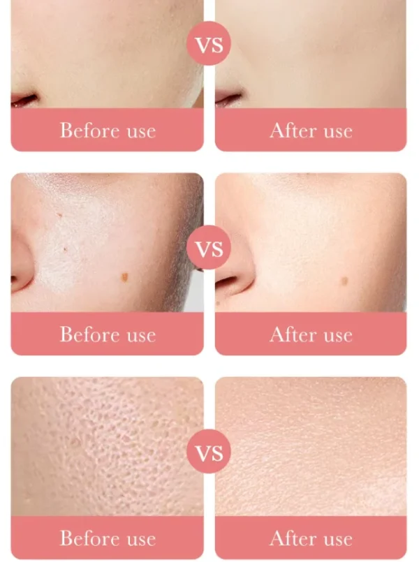 سيروم الورد وحمض الهيالورونيك - ترطيب تفتيح تجديد وللمسامات Hyaluronic Acid Rose Serum (7) سيروم الورد وحمض الهيالورونيك - ترطيب تفتيح تجديد وللمسامات Hyaluronic Acid Rose Serum