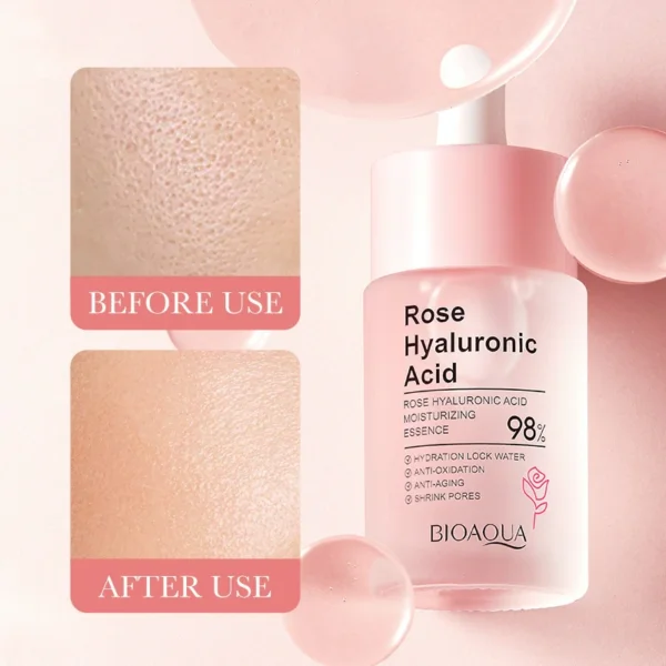 سيروم الورد وحمض الهيالورونيك - ترطيب تفتيح تجديد وللمسامات Hyaluronic Acid Rose Serum (9) بكج 5 قطع الورد وحمض الهيالورونيك (تونر + لوشن + كريم العين + سيروم + غسول) Rose Hyaluronic