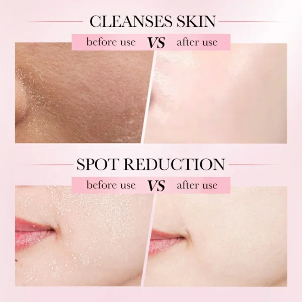 غسول 4×1 فوم رغوة فيتامين C&E و النياسيناميد والهيالورونيك SADOER Facial Cleansing Mousse