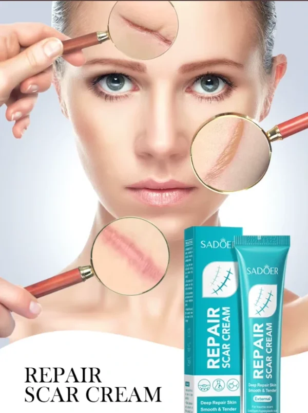 كريم SADOER لترميم الجلد من اثار الندبات والحروق وآثار الجروح والعمليات وتجديد البشرة (2) كريم SADOER لـ ترميم الجلد من اثار الندبات والحروق وآثار الجروح والعمليات وتجديد البشرة
