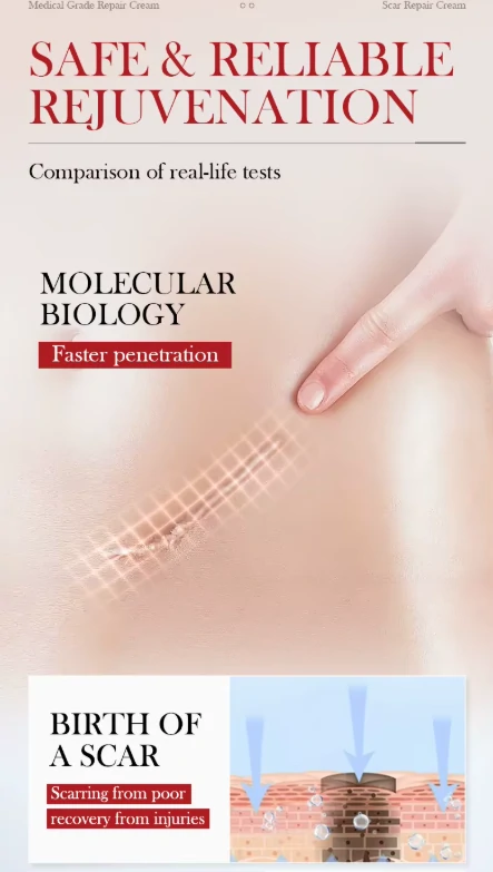 كريم SADOER لترميم الجلد من اثار الندبات والحروق وآثار الجروح والعمليات وتجديد البشرة (4) كريم SADOER لـ ترميم الجلد من اثار الندبات والحروق وآثار الجروح والعمليات وتجديد البشرة