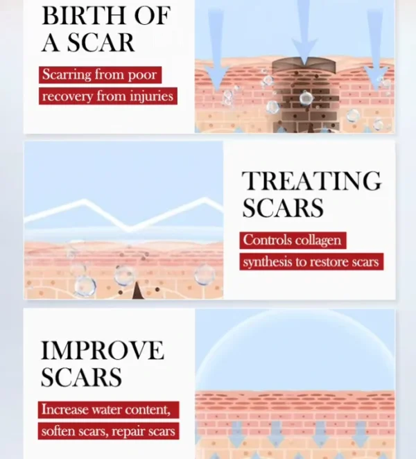 كريم SADOER لترميم الجلد من اثار الندبات والحروق وآثار الجروح والعمليات وتجديد البشرة (5) كريم SADOER لـ ترميم الجلد من اثار الندبات والحروق وآثار الجروح والعمليات وتجديد البشرة