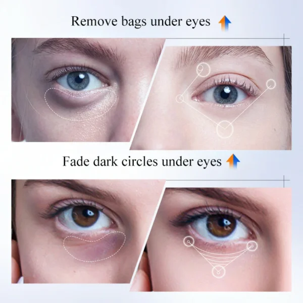 كريم العيون  Vitamin C + Retinol الثنائي نهاري وليلي يعالج الهالات بأنواعها