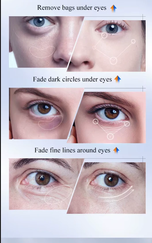 كريم العيون  Vitamin C + Retinol الثنائي نهاري وليلي يعالج الهالات بأنواعها