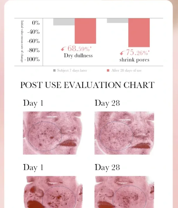 لوشن الورد وحمض الهيالورونيك - ترطيب عميق وتفتيح وشد للبشرة Rose Hyaluronic Acid Lotion (2) لوشن الورد وحمض الهيالورونيك - ترطيب عميق وتفتيح وشد للبشرة Rose Hyaluronic Acid Lotion