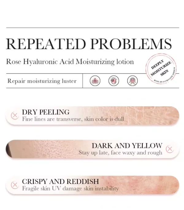 لوشن الورد وحمض الهيالورونيك - ترطيب عميق وتفتيح وشد للبشرة Rose Hyaluronic Acid Lotion (4) لوشن الورد وحمض الهيالورونيك - ترطيب عميق وتفتيح وشد للبشرة Rose Hyaluronic Acid Lotion