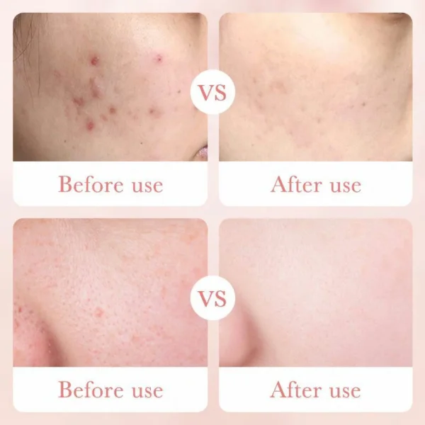 لوشن الورد وحمض الهيالورونيك - ترطيب عميق وتفتيح وشد للبشرة Rose Hyaluronic Acid Lotion (5) لوشن الورد وحمض الهيالورونيك - ترطيب عميق وتفتيح وشد للبشرة Rose Hyaluronic Acid Lotion