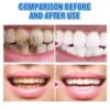 مسحوق بودرة تبييض الاسنان بحمض الهيالورونيك لإزالة التصبغات والجير والبلاك