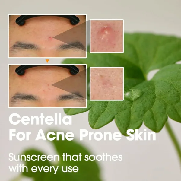 واقي شمس SOME BY MI V10 Hyal Air Fit Sunscreen SPF50 تركيبة النياسيناميد والهيالورونيك - منتجات كورية