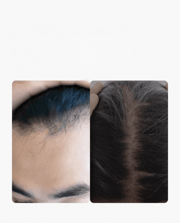 سيروم مكثف لعلاج تساقط الشعر وتقوية فروة الرأس - Seapuri Dr.33 Hair Ampoule 20ml