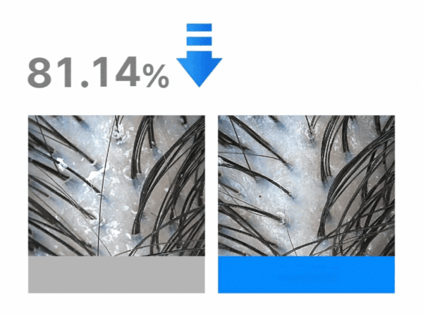 سيروم مكثف لعلاج تساقط الشعر وتقوية فروة الرأس - Seapuri Dr.33 Hair Ampoule 20ml