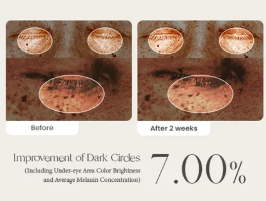 سيروم العيون كولاجين نباتي تجاعيد وانتفاخ وهالات + رأس مساج AXIS-Y Eye Vegan Collagen  – منتجات كورية