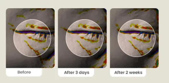 بكج تفتيح الهالات وشد منطقة تحت العين وتقليل الانتفاخ AXIS-Y Eye Brightening & Firming Set - منتجات كورية