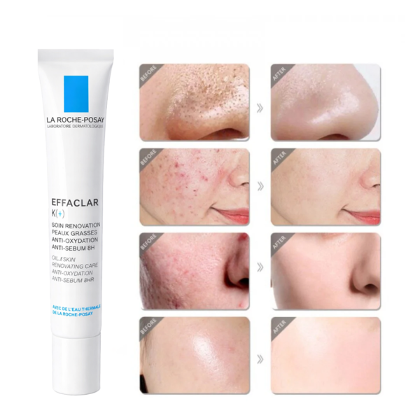 بكج La Roche-Posay Effaclar للبشرة الدهنية والحبوب والرؤوس السوداء (Purifying Gel + Effaclar K+)