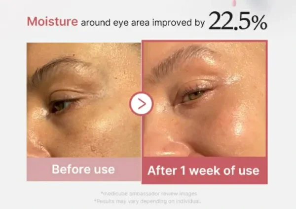 سيروم Medicube شد تجاعيد العيون PDRN Pink Peptide Eye Cream  – منتجات كورية