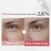 سيروم Medicube شد تجاعيد العيون PDRN Pink Peptide Eye Cream  – منتجات كورية