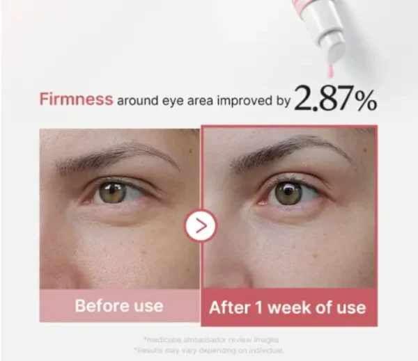 سيروم Medicube شد تجاعيد العيون PDRN Pink Peptide Eye Cream  – منتجات كورية