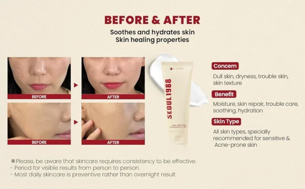 كريم مخاط الحلزون شد، ترميم، ترطيب عميق SEOUL 1988 Cream : Snail Mucin 93% + Rice - منتجات كورية