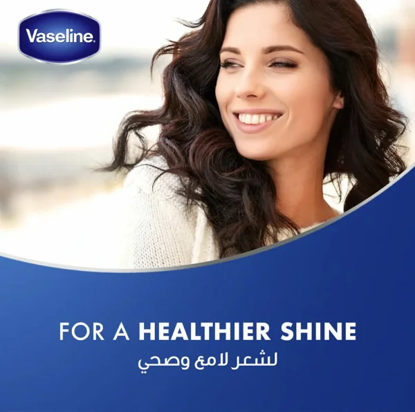 تونك للشعر Vaseline Hair and Scalp Tonic – يغذي فروة الرأس ويمنع الجفاف والقشرة