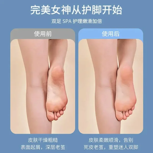 جهاز  مبرد و إزالة الجلد الميت الكهربائي للقدمين