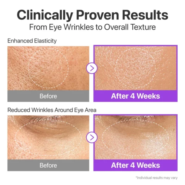 كريم العيون Numbuzin المتطور التجاعيد، شد الترهلات، الهالات NAD+ Retinol - منتجات كورية