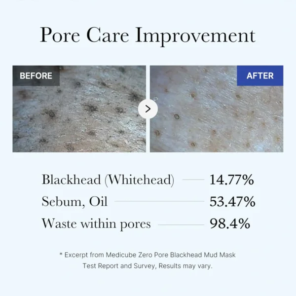 ماسك Medicube الطين لإزالة الرؤوس السوداء وتضييق المسام خلال 3 دقائق - منتجات كورية