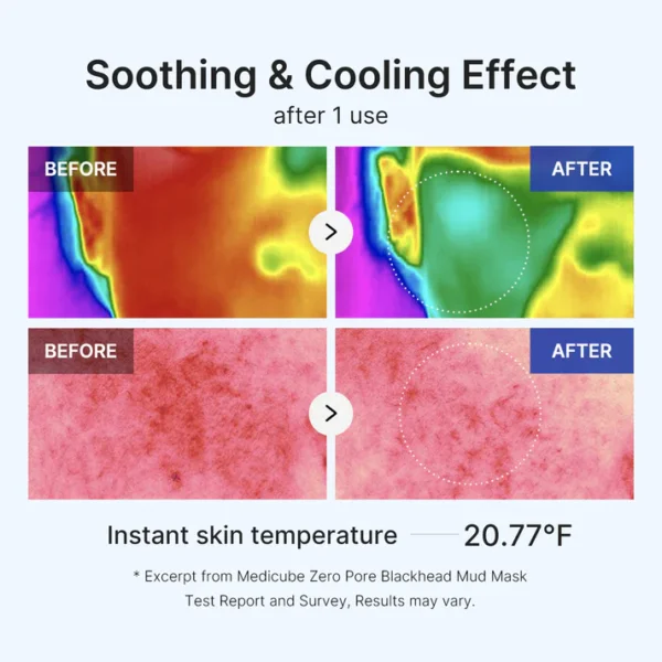 بكج البشرة الصافية (بدون حبوب ومسامات) Medicube Clear Skin - منتجات كورية