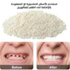 معجون راتنج لتشكيل سن مؤقت (Moldable False Teeth) حبيبات ريزن قابلة للتشكيل
