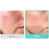 بكج البشرة الصافية (بدون حبوب ومسامات) Medicube Clear Skin - منتجات كورية