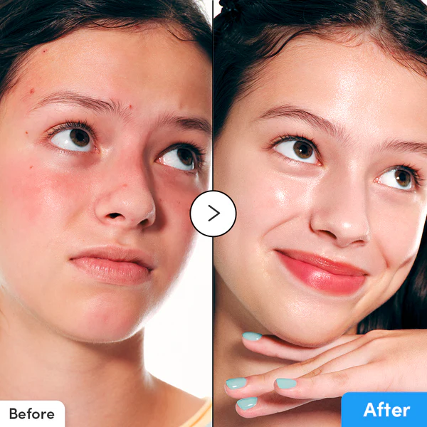 سيروم ترطيب عميق EQQUALBERRY Hyaltoin Flooding Smoothie وإصلاح حاجز البشرة - منتجات كورية